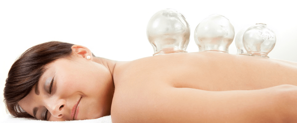 Cupping